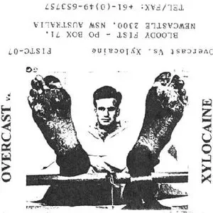 Photo représentant Xylocaine