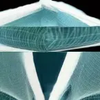 Pochette Skein of Veins