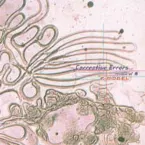 Pochette Corrective Errors〜remix of 舟