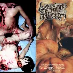 Pochette Disgusting Gore and Pathology / Polymorphisms to Severe Sepsis in Trauma