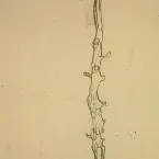 Pochette Nothing Under a Microscope