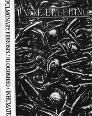 Pochette de Unite Bleeding de Pulmonary Fibrosis