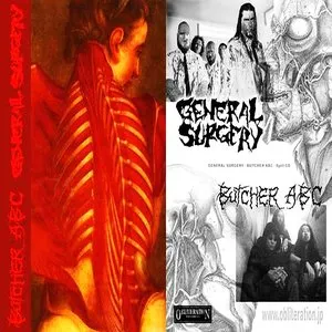 Pochette de General Surgery / Butcher ABC de General Surgery