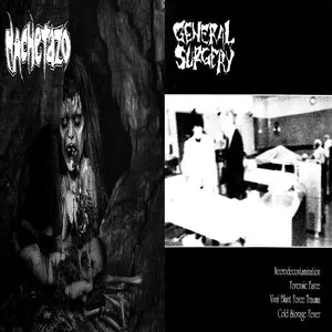 Pochette de General Surgery / Machetazo de General Surgery