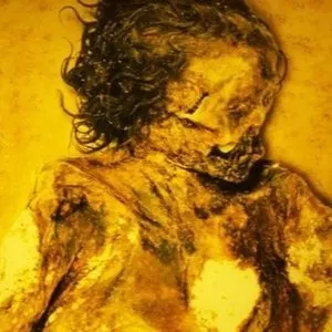 Pochette de Hyperemesis / Agathocles de Agathocles