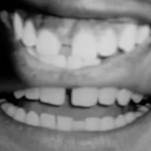 Pochette de Rearrange My World / There’s a Field (That’s Only Yours) de Daniel Caesar